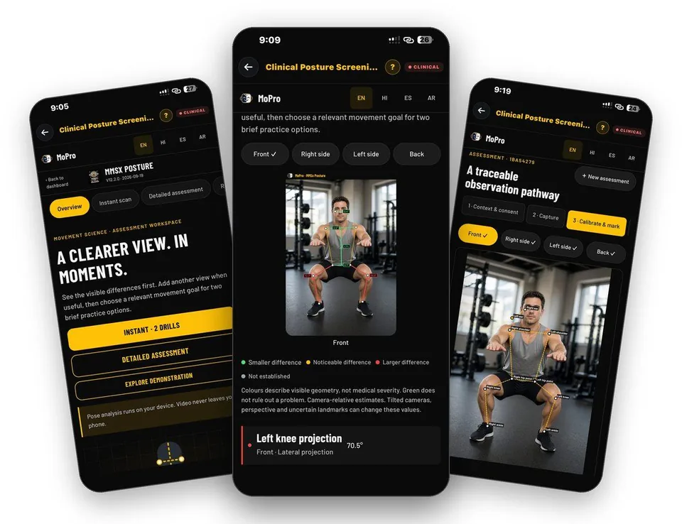 TrainersEye Clinical Posture Screening on iPhone: Posture assessment