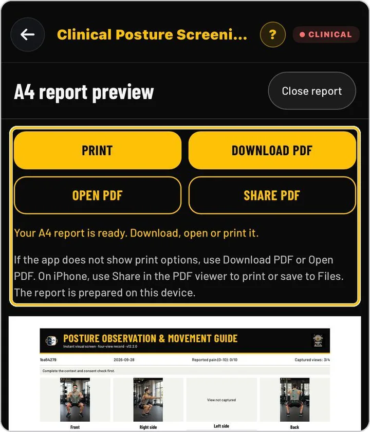 TrainersEye Clinical Posture Screening finished output preview