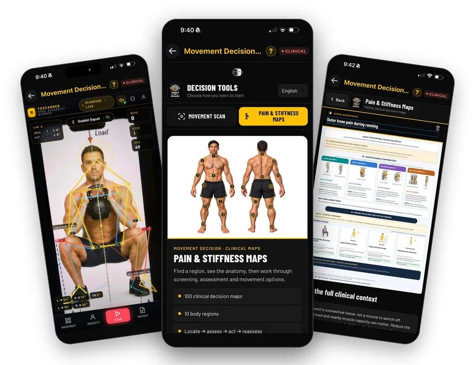 TrainersEye Movement Decision Tool on iPhone: Physiotherapists