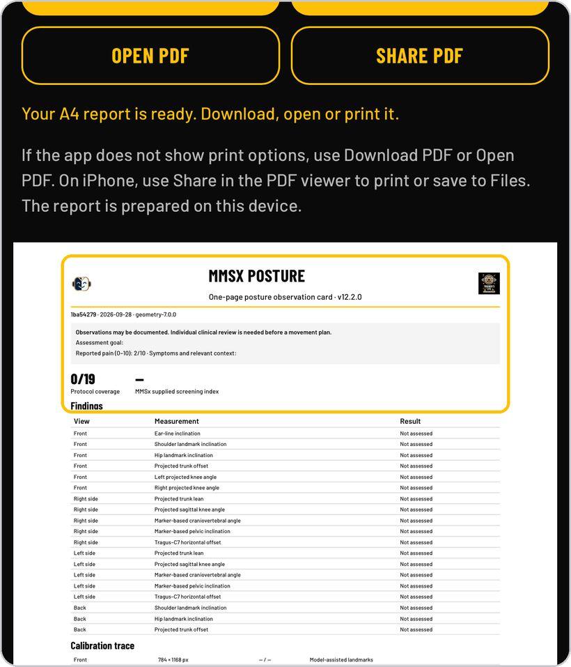 Clinical Posture Screening · The one-page observation card