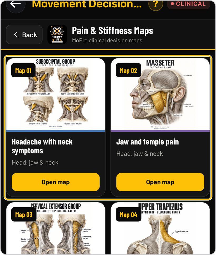 Movement Decision Tool · Open a map