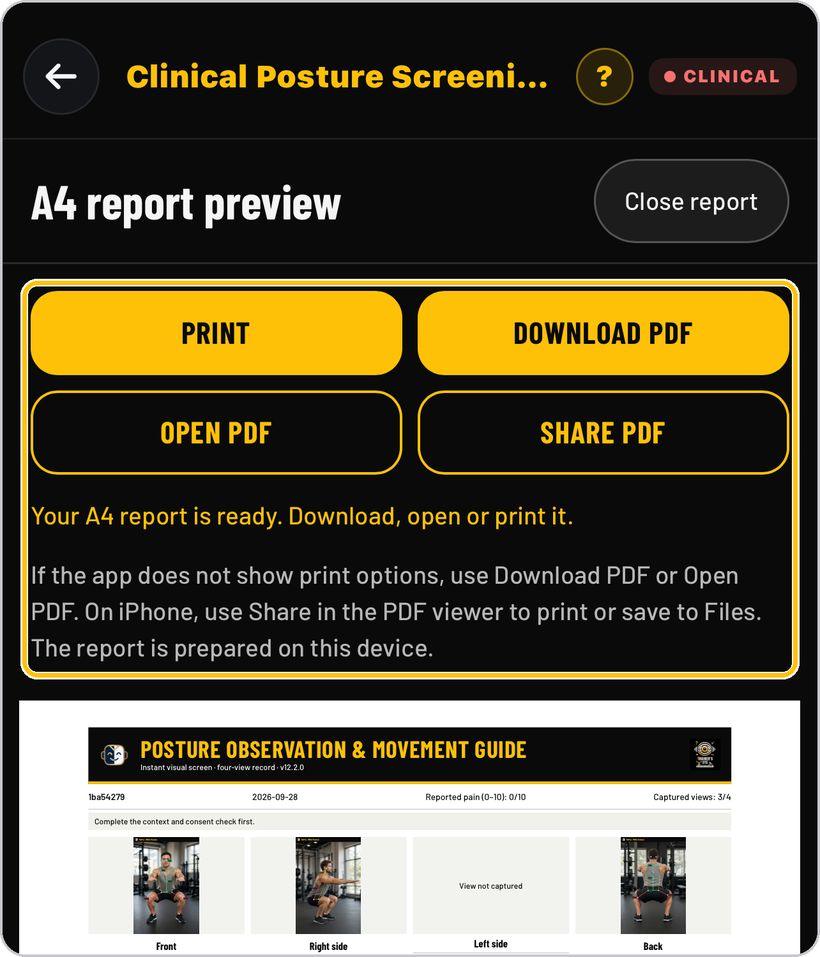 Clinical Posture Screening · Print or save the report