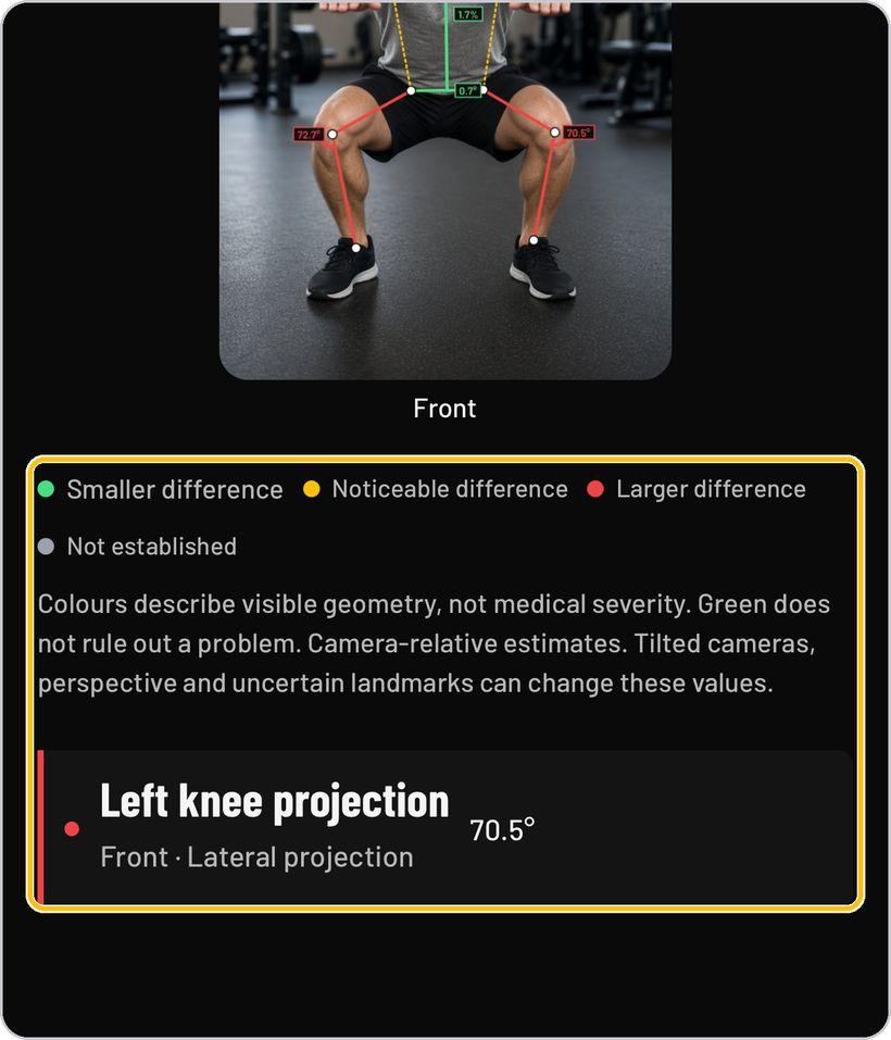 Clinical Posture Screening · Read the findings