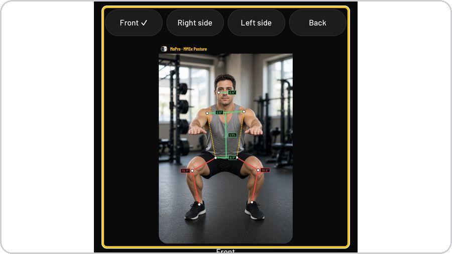 Clinical Posture Screening · Read a view