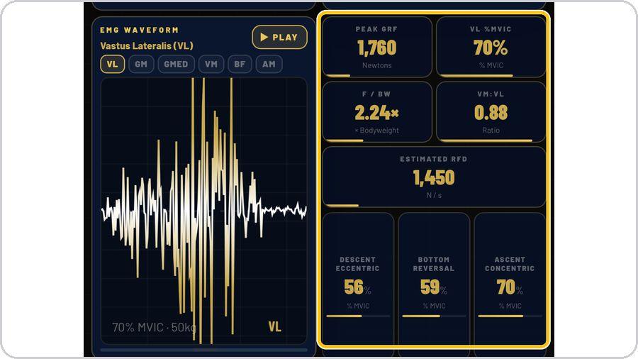 EMG Lab · Read the numbers