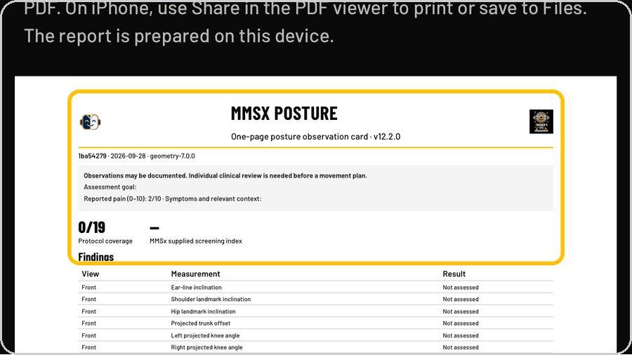Clinical Posture Screening · The one-page observation card
