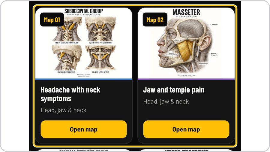 Movement Decision Tool · Open a map